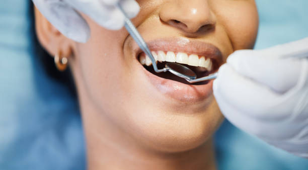 Best Emergency Gum Pain Relief  in Shadyside, OH